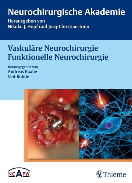 Produktbild: Vaskul&auml;re Neurochirurgie Funktionelle Neurochirurgie