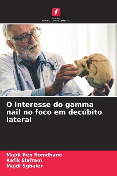 Produktbild: O interesse do gamma nail no foco em dec&uacute;bito lateral