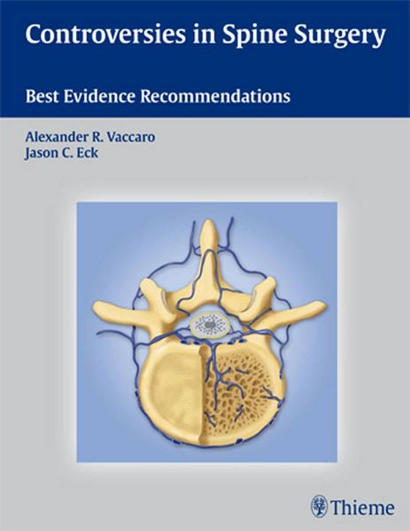 Produktbild: Controversies in Spine Surgery