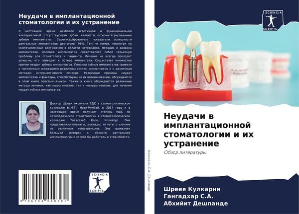 Produktbild: Neudachi w implantacionnoj stomatologii i ih ustranenie