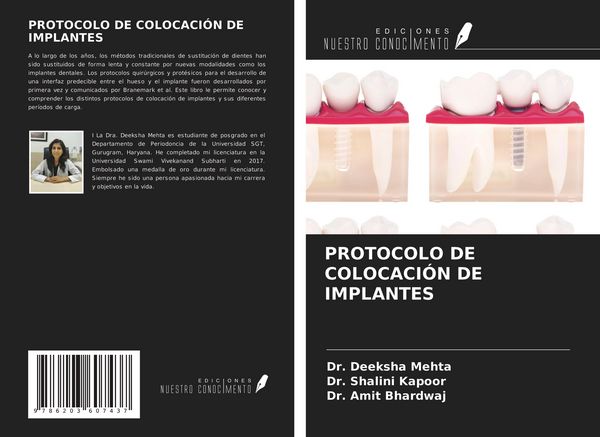 Produktbild: Protocolo De Colocaci&oacute;n De Implantes