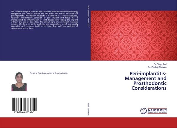 Produktbild: Peri-implantitis- Management and Prosthodontic Considerations