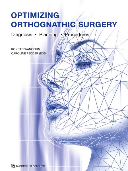 Produktbild: Optimizing Orthognathic Surgery