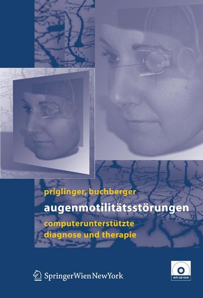 Produktbild: Augenmotilit&auml;tsst&ouml;rungen