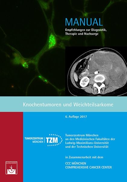 Produktbild: Knochentumoren und Weichteilsarkome