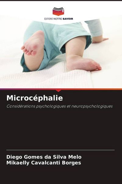 Produktbild: Microc&eacute;phalie