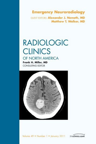 Produktbild: Emergency Neuroradiology, an Issue of Radiologic Clinics of North America