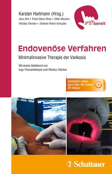 Produktbild: Endoven&ouml;se Verfahren