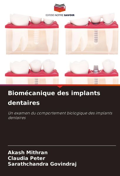 Produktbild: Biom&eacute;canique des implants dentaires