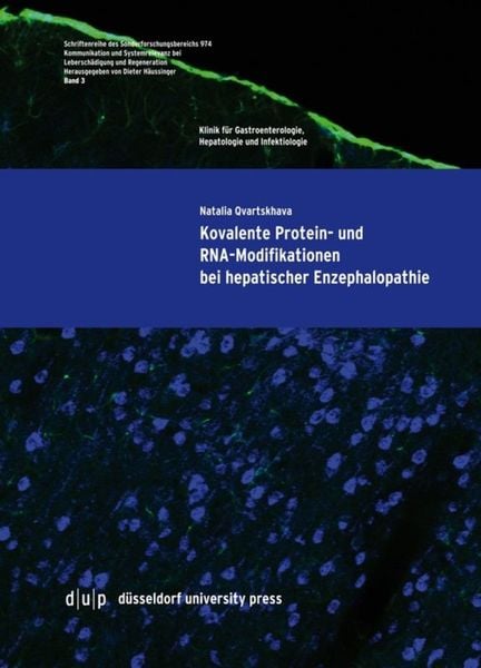 Produktbild: Kovalente Protein- und RNA-Modifikationen bei hepatischer Enzephalopathie