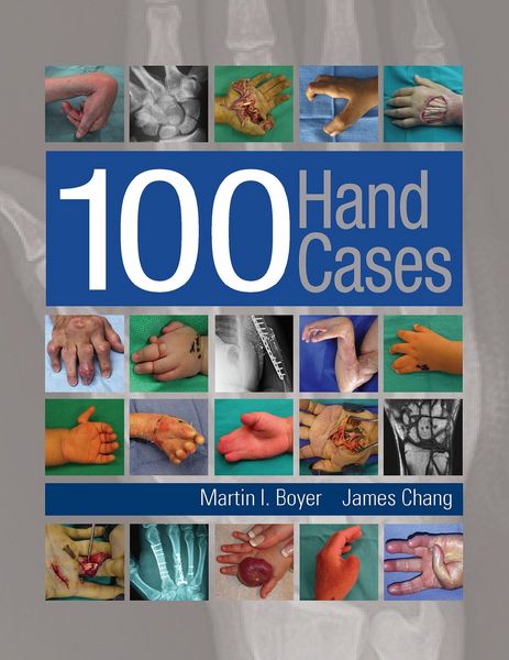 Produktbild: 100 Hand Cases