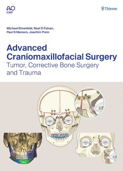 Produktbild: Advanced Craniomaxillofacial Surgery