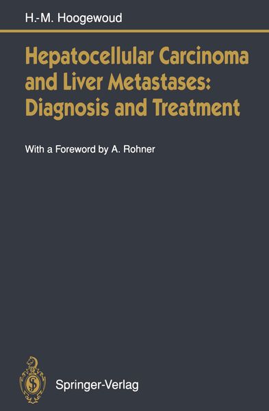 Produktbild: Hepatocellular Carcinoma and Liver Metastases: Diagnosis and Treatment