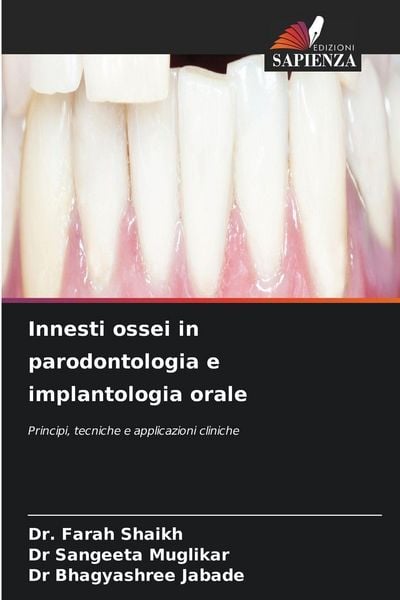 Produktbild: Innesti ossei in parodontologia e implantologia orale