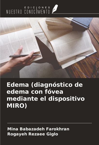 Produktbild: Edema (diagn&oacute;stico de edema con f&oacute;vea mediante el dispositivo MIRO)