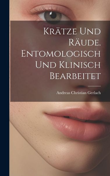 Produktbild: Kr&auml;tze und R&auml;ude. Entomologisch und klinisch bearbeitet