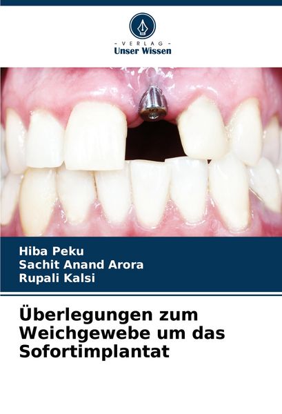 Produktbild: &Uuml;berlegungen zum Weichgewebe um das Sofortimplantat