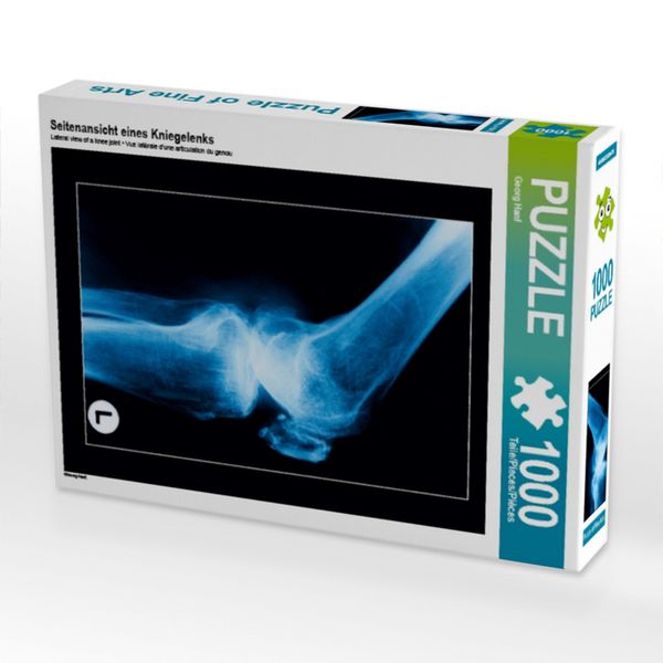 Seitenansicht eines Kniegelenks (Puzzle)