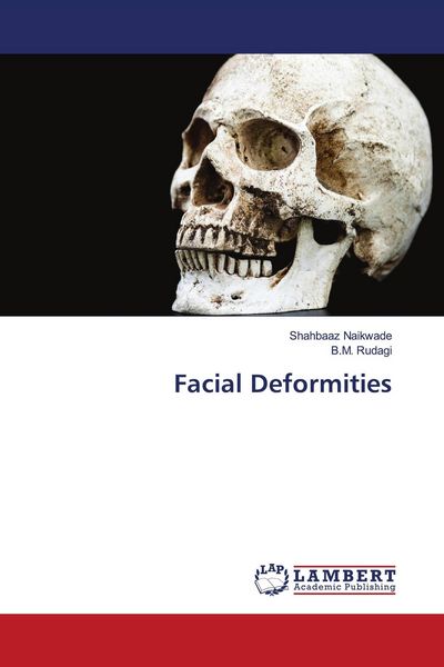 Produktbild: Facial Deformities