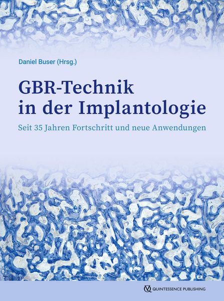 Produktbild: GBR-Technik in der Implantologie