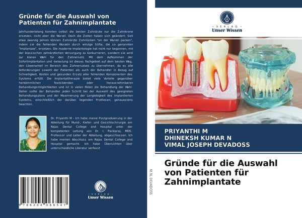 Produktbild: Gr&uuml;nde f&uuml;r die Auswahl von Patienten f&uuml;r Zahnimplantate