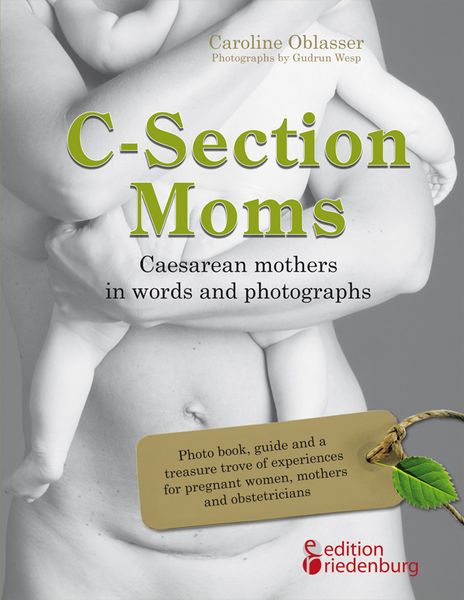 Produktbild: C-Section Moms - Caesarean mothers in words and photographs