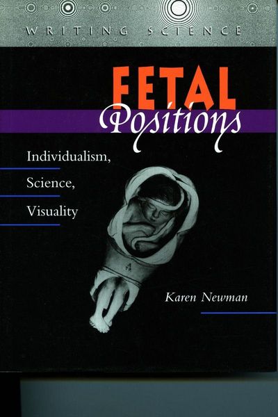 Produktbild: Fetal Positions