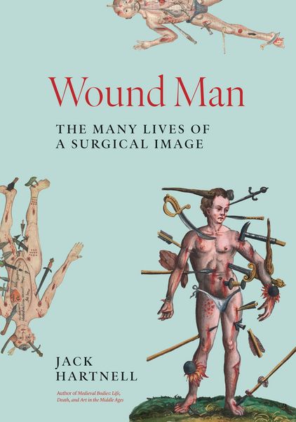 Produktbild: Wound Man