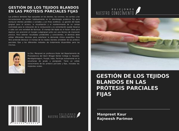 Produktbild: Gesti&oacute;n De Los Tejidos Blandos En Las Pr&oacute;tesis Parciales Fijas