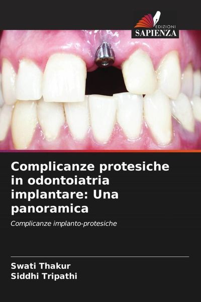 Produktbild: Complicanze protesiche in odontoiatria implantare: Una panoramica