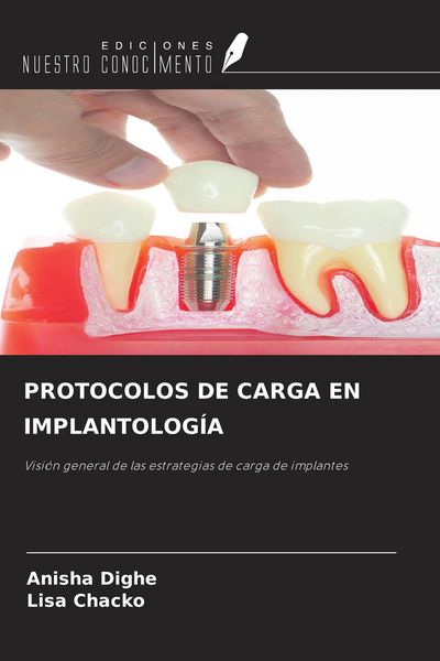 Produktbild: PROTOCOLOS DE CARGA EN IMPLANTOLOG&Iacute;A