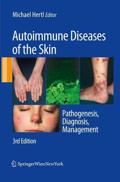 Produktbild: Autoimmune Diseases of the Skin