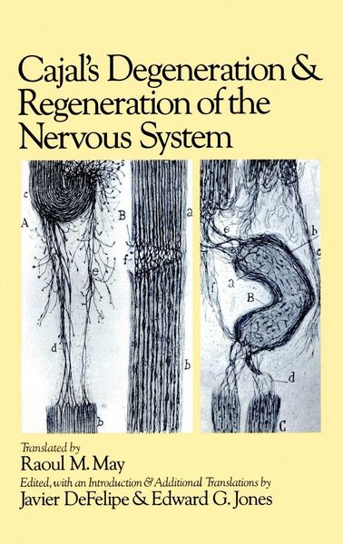Produktbild: Cajal's Degeneration Hn C