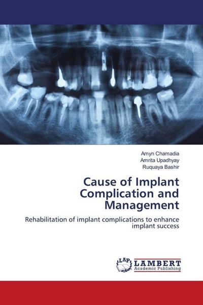Produktbild: Cause of Implant Complication and Management