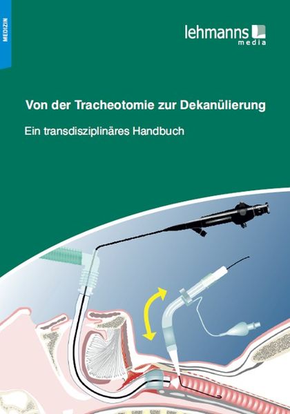 Produktbild: Von der Tracheotomie zur Dekan&uuml;lierung