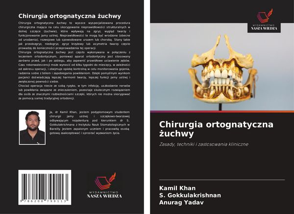 Produktbild: Chirurgia ortognatyczna &iquest;uchwy