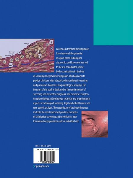 Produktbild: Screening and Preventive Diagnosis with Radiological Imaging
