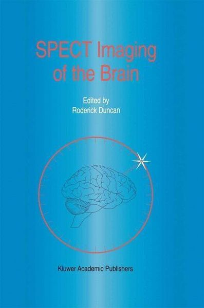 Produktbild: SPECT Imaging of the Brain