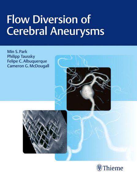 Produktbild: Flow Diversion of Cerebral Aneurysms