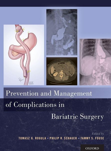 Produktbild: Prevention and Management of Complications in Bariatric Surgery
