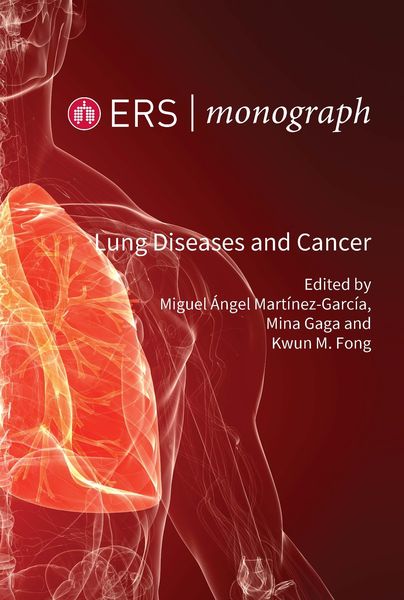 Produktbild: Lung Diseases and Cancer