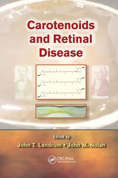 Produktbild: Carotenoids and Retinal Disease