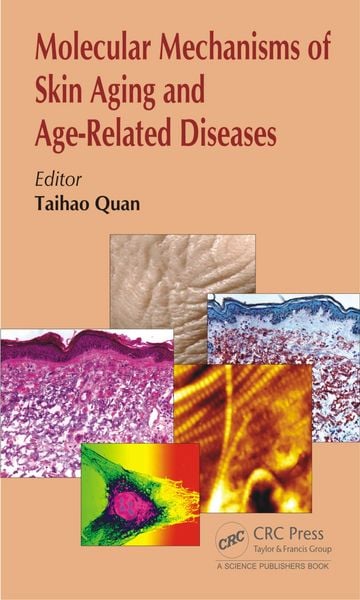 Produktbild: Molecular Mechanisms of Skin Aging and Age-Related Diseases