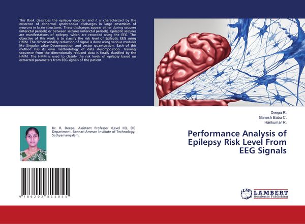 Produktbild: Performance Analysis of Epilepsy Risk Level From EEG Signals