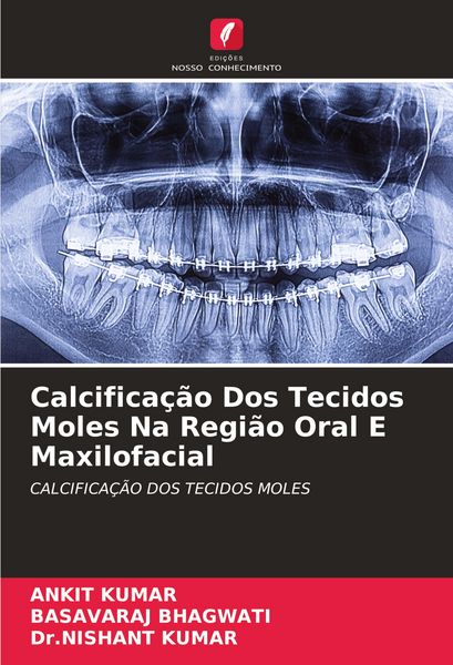 Produktbild: Calcifica&ccedil;&atilde;o Dos Tecidos Moles Na Regi&atilde;o Oral E Maxilofacial