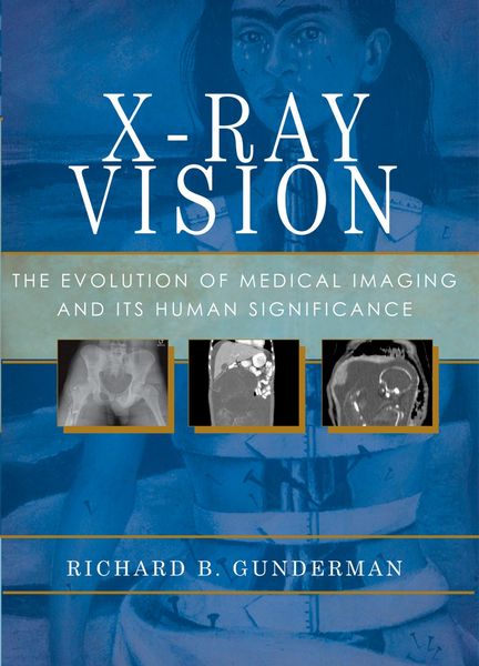 Produktbild: X-Ray Vision