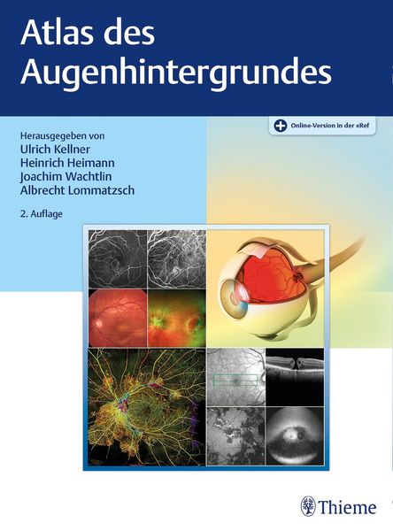 Produktbild: Atlas des Augenhintergrundes