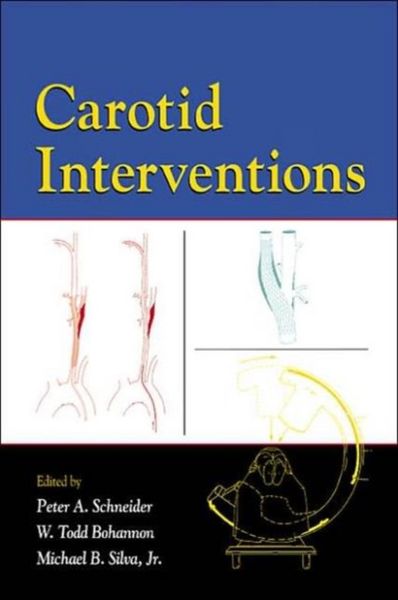 Produktbild: Carotid Interventions