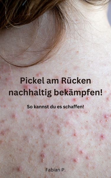 Produktbild: Pickel am R&uuml;cken nachhaltig bek&auml;mpfen!