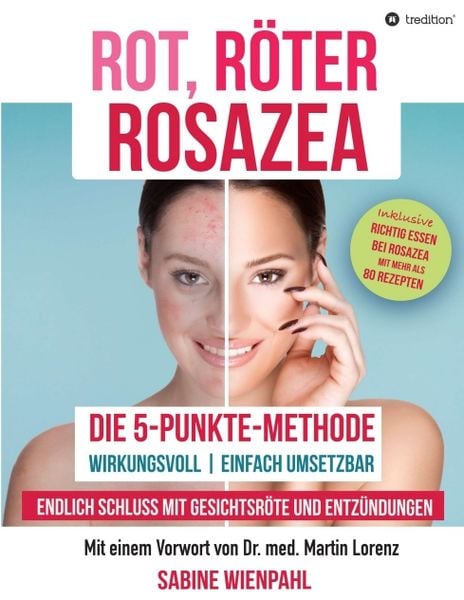 Produktbild: Rot R&ouml;ter Rosazea